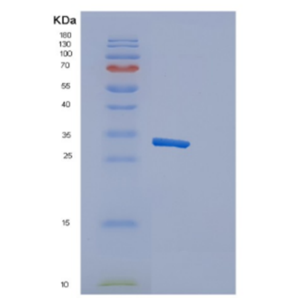 Recombinant Human Cytotoxic and regulatory T-cell molecule Protein