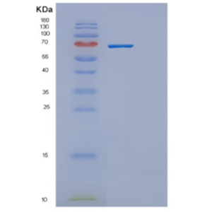 Recombinant Human DBH Protein,Recombinant Human DBH Protein