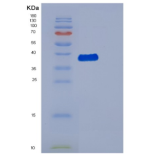 Recombinant Human DBR1 Protein,Recombinant Human DBR1 Protein