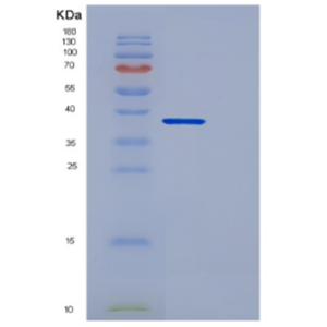 Recombinant Human DCN Protein,Recombinant Human TAU Protein