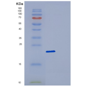 Recombinant Human DCTD Protein,Recombinant Human DCTD Protein