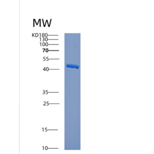 Recombinant Human CTSW Protein,Recombinant Human CTSW Protein