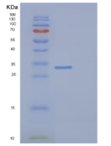 Recombinant Human DCUN1D1 Protein,Recombinant Human DCUN1D1 Protein