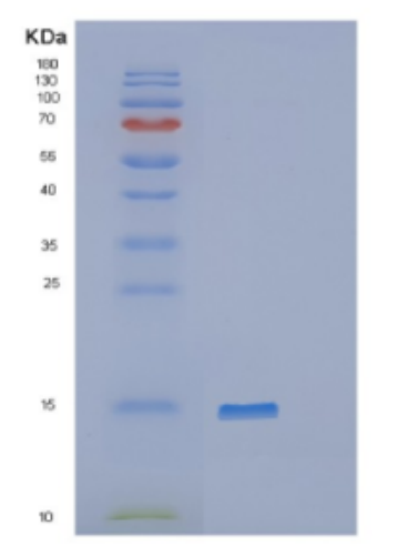 Recombinant Human DDT Protein,Recombinant Human DDT Protein