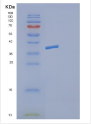 Recombinant Mouse Decorin Protein,Recombinant Mouse Decorin Protein