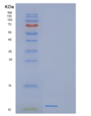 Recombinant Human DEFB116 Protein,Recombinant Human DEFB116 Protein