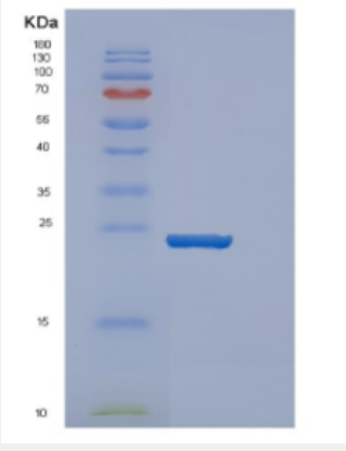 Recombinant Human DENR Protein,Recombinant Human DENR Protein