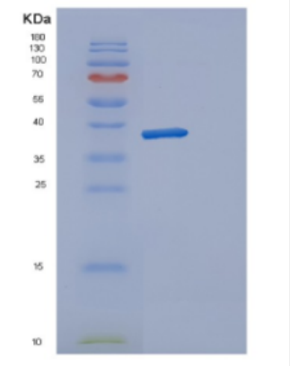 Recombinant Human DERA Protein,Recombinant Human DERA Protein