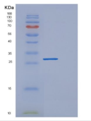 Recombinant Human DGCR6 Protein,Recombinant Human DGCR6 Protein