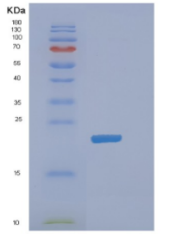 Recombinant Mouse DHFR Protein,Recombinant Mouse DHFR Protein