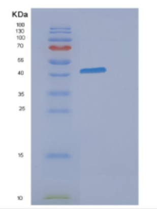 Recombinant Human DHODH Protein,Recombinant Human DHODH Protein