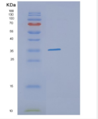 Recombinant Human DHRS9 Protein,Recombinant Human DHRS9 Protein