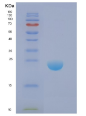 Recombinant Human DIRAS1 Protein,Recombinant Human DIRAS1 Protein