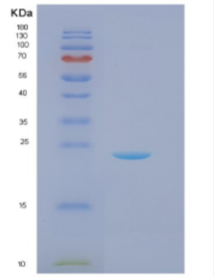 Recombinant Recombinant DJ-1(PARK7) Protein,Recombinant Recombinant DJ-1(PARK7) Protein