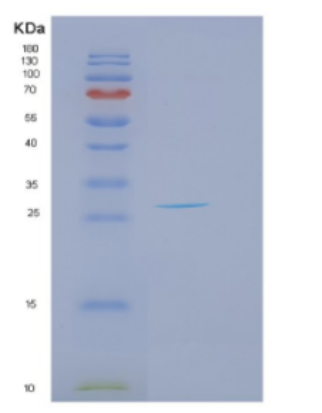 Recombinant Human DKK2 Protein,Recombinant Human DKK2 Protein