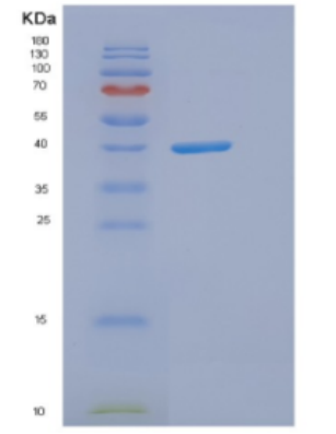 Recombinant Human DNAJB11 Protein,Recombinant Human DNAJB11 Protein