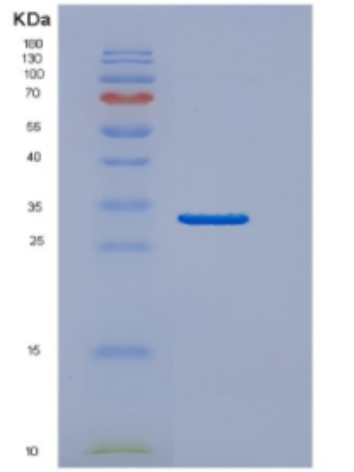 Recombinant Human DNAJB2 Protein,Recombinant Human DNAJB2 Protein