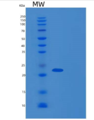 Recombinant Human DCTN6 Protein,Recombinant Human DCTN6 Protein