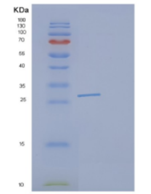 Recombinant Human DCXR Protein,Recombinant Human DCXR Protein