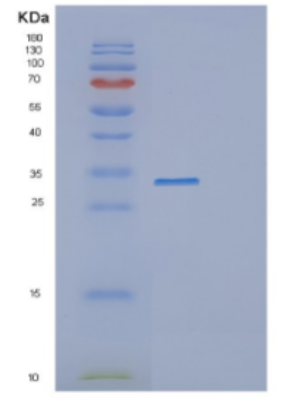 Recombinant Human DDX39A Protein,Recombinant Human DDX39A Protein