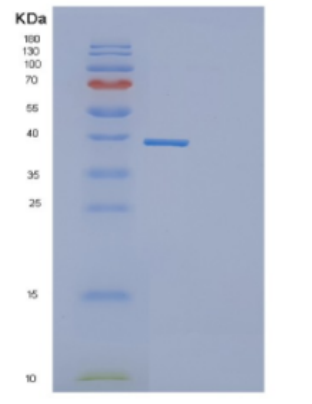 Recombinant Human DEDD Protein,Recombinant Human DEDD Protein