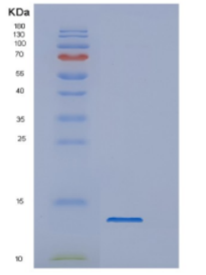 Recombinant Dengue virus 2DENV Protein,Recombinant Dengue virus 2DENV Protein