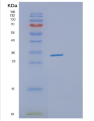 Recombinant Human DHRS4 Protein,Recombinant Human DHRS4 Protein