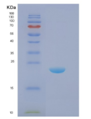 Recombinant E.coli Disulfide oxidoreductase (DsbA) E.coli Protein,Recombinant E.coli Disulfide oxidoreductase (DsbA) E.coli Protein