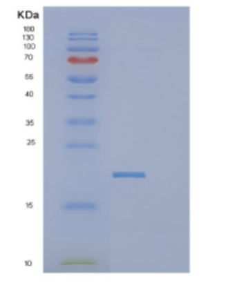 Recombinant Human DCTPP1 Protein,Recombinant Human DCTPP1 Protein