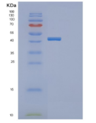 Recombinant Human DDR2 Protein,Recombinant Human DDR2 Protein