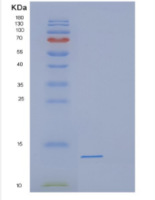 Recombinant Human DEFB118 Protein,Recombinant Human DEFB118 Protein