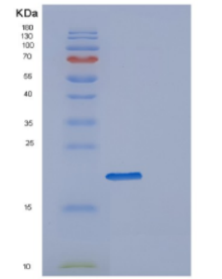 Recombinant Human DESI1 Protein,Recombinant Human DESI1 Protein