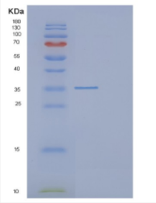 Recombinant Human DCUN1D4 Protein,Recombinant Human DCUN1D4 Protein