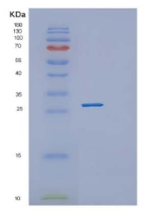 Recombinant Human DGCR6L Protein,Recombinant Human DGCR6L Protein