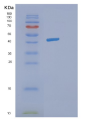 Recombinant Human DHPS Protein,Recombinant Human DHPS Protein