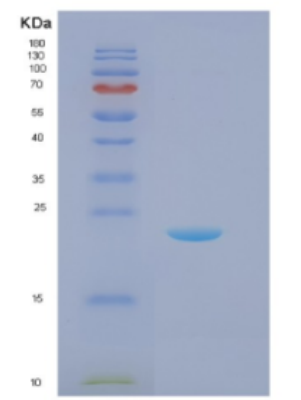 Recombinant E.coli Disulfide-bond isomerase (DsbC) E.coli Protein,Recombinant E.coli Disulfide-bond isomerase (DsbC) E.coli Protein