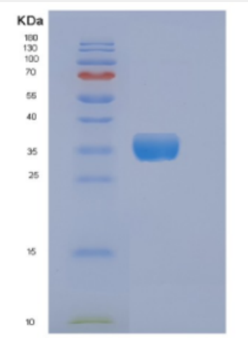 Recombinant Human DKK3 Protein,Recombinant Human DKK3 Protein