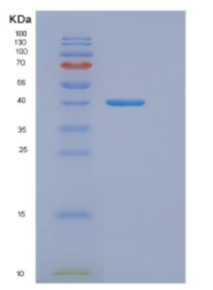 Recombinant E.coli DnaJ (Amino acids 1-376) Protein,Recombinant E.coli DnaJ (Amino acids 1-376) Protein