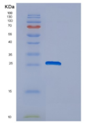 Recombinant Human DNAJC12 Protein,Recombinant Human DNAJC12 Protein