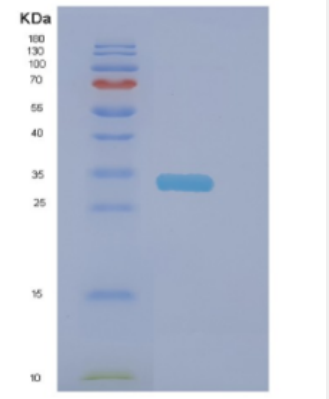 Recombinant Human DNAJC27 Protein,Recombinant Human DNAJC27 Protein