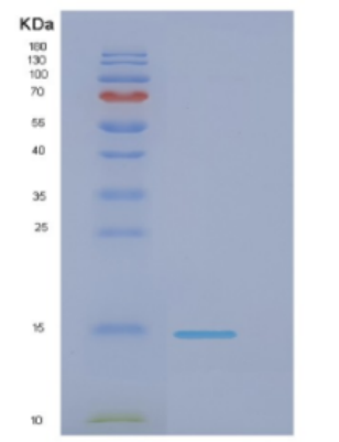 Recombinant E.coli Dnak(508-638); A lid covering the substrate Protein,Recombinant E.coli Dnak(508-638); A lid covering the substrate Protein