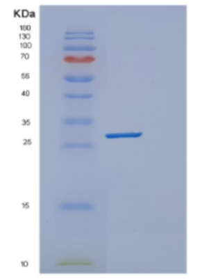 Recombinant Human deoC Protein,Recombinant Human deoC Protein