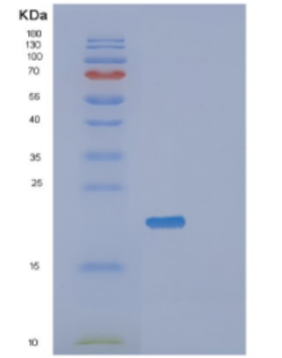 Recombinant Human Diamine N-acetyltransferase 1 Protein,Recombinant Human Diamine N-acetyltransferase 1 Protein