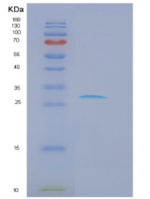 Recombinant Human DKK1 Protein,Recombinant Human DKK1 Protein