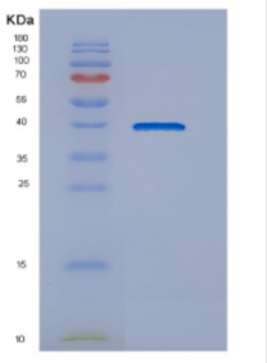 Recombinant Human DNAJB4 Protein,Recombinant Human DNAJB4 Protein