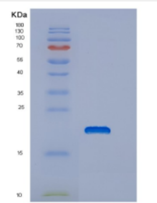 Recombinant Human DNAJC24 Protein,Recombinant Human DNAJC24 Protein