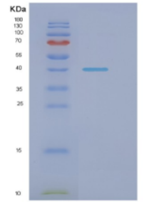 Recombinant E.coli Dnak(N-term;1-384) Protein,Recombinant E.coli Dnak(N-term;1-384) Protein