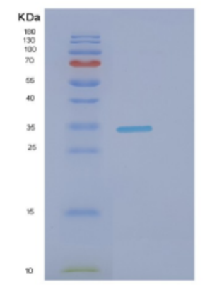 Recombinant Human DNALI1 Protein,Recombinant Human DNALI1 Protein