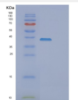 Recombinant Human DOK4 Protein,Recombinant Human DOK4 Protein