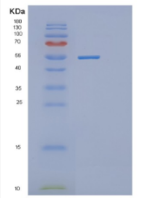 Recombinant Human DDX56 Protein,Recombinant Human DDX56 Protein